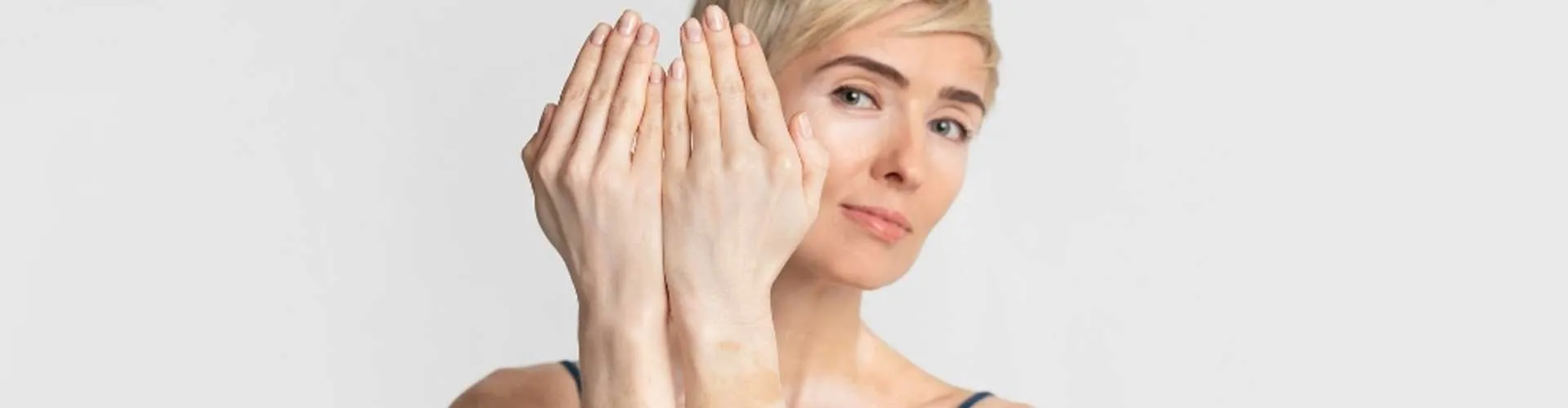Summer Precautions for People with Vitiligo