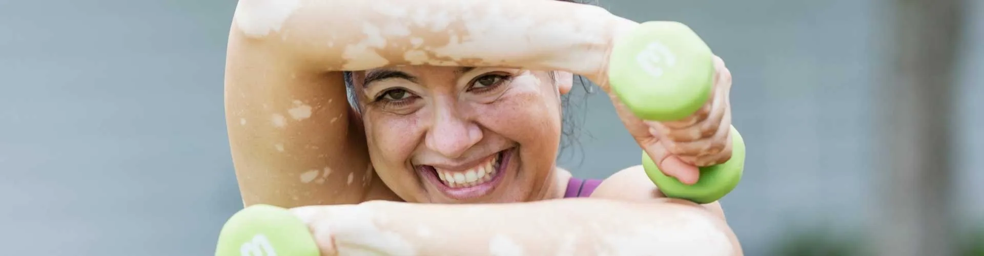 Vitiligo ve Spor: Egzersizlerin Etkisi Var mı?