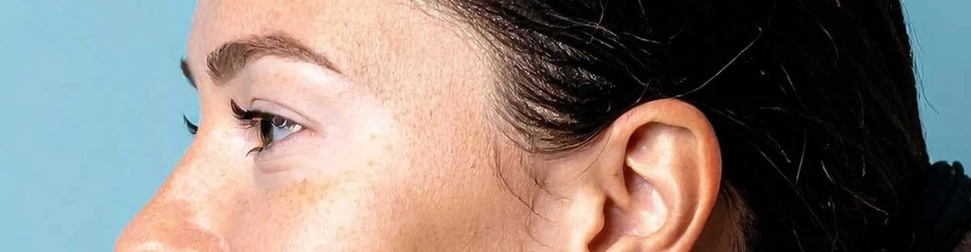 Yüzde Çıkan Beyaz Lekeler Her Zaman Vitiligo Mudur? Ayırıcı Tanılar, Klinik Bulgular ve Dermatolojik İnceleme