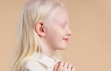 Vitiligo vs Albinism: Understanding the Key Differences in Origin, Symptoms, and Management