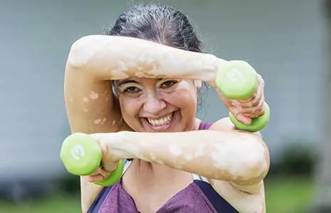Vitiligo ve Spor: Egzersizlerin Etkisi Var mı?