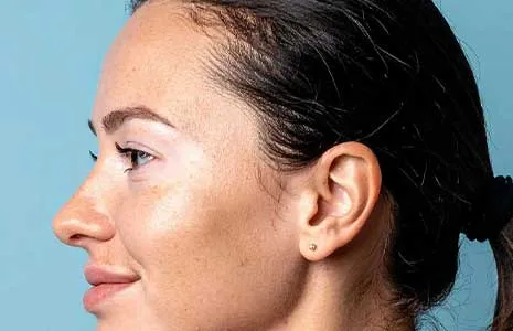 Are All White Patches on the Face a Sign of Vitiligo? Differential Diagnosis and Clinical Insights
