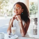 Social Challenges Faced by People with Vitiligo