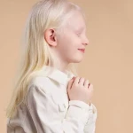 Vitiligo vs Albinism: Understanding the Key Differences in Origin, Symptoms, and Management