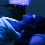 Is Phototherapy Effective in the Treatment of Vitiligo? A Comprehensive Scientific Overview