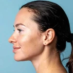 Are All White Patches on the Face a Sign of Vitiligo? Differential Diagnosis and Clinical Insights